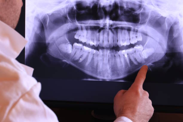Best Emergency Dental Care for Broken or Chipped Teeth in Cuthbert, GA